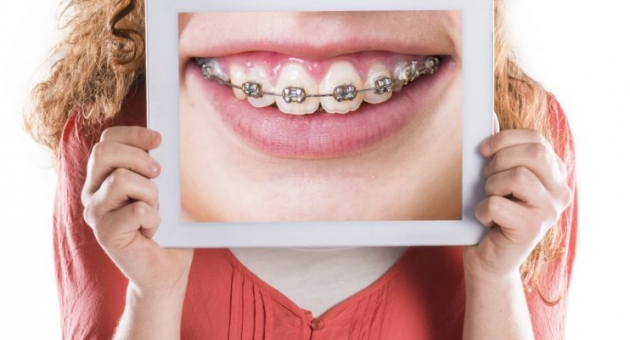  ��������: ��� �� �����?