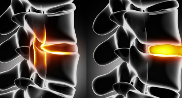  ̳��������� �����: �� ������� �����?