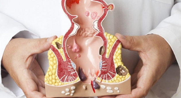  �������� �������: ��� ����� �����?