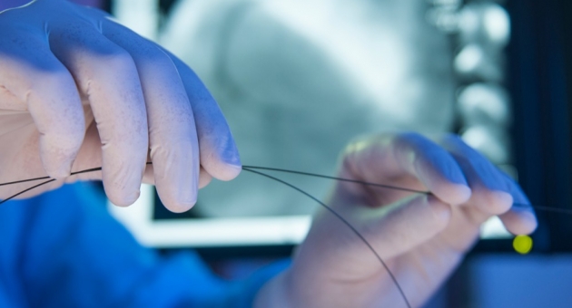  Interventional treatments in cardiology