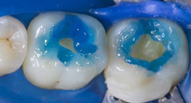  ���������� ������� 5 ���������: ����������� � ������������