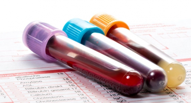  ����� � ���� �������� ����� ����?